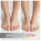 🖤See Real Results Faster🖤Nail Repair Essence for Damaged Nails💅🏻